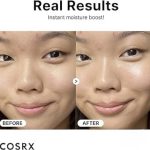 مرطوب كننده هيالورونيك اسيد كوزاركس - تصویر 4