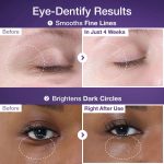 دور چشم نامبوزين حاوي NAD+ و رتينول - تصویر 3