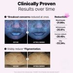 بوستر ٦ پپتايد كوزاركس - تصویر 4