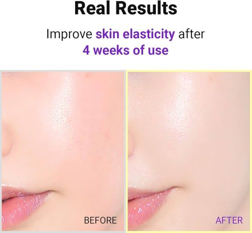 سرم رتينول ايزنتري اصل - تصویر 5