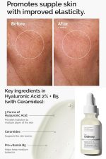 سرم ابرسان هيالورونيك اسيد و سراميد اوردينري اصل - تصویر 2